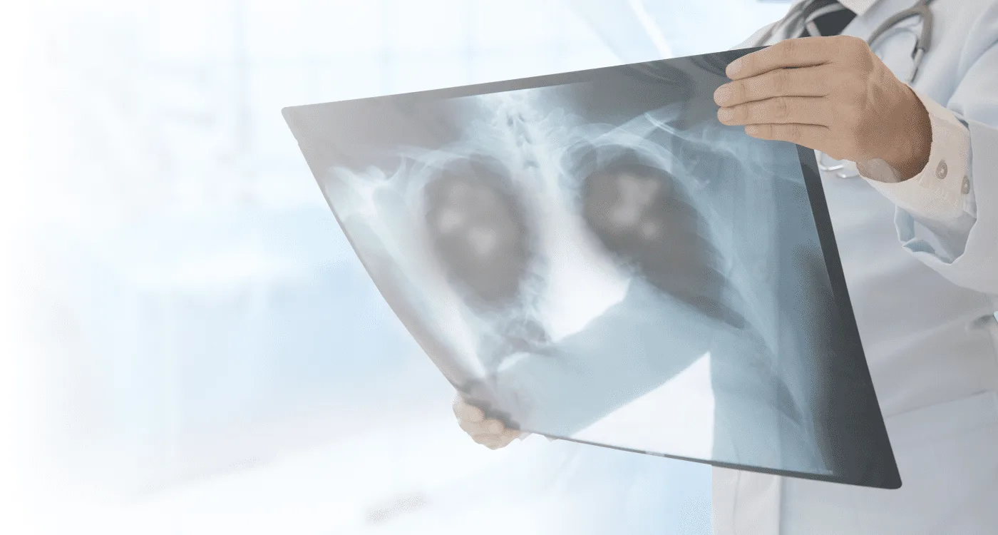 Especialista en Infecciones Pediátricas en Santiago de Surco Lima
